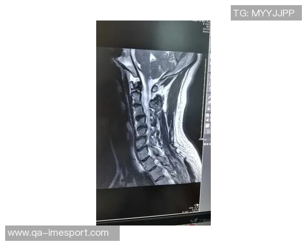 邓弗里斯今日将决定手术与否国米关注帕莱斯特拉和库菲动态